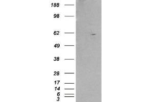 Western Blotting (WB) image for anti-Retinoid X Receptor, beta (RXRB) antibody (ABIN5876651) (Retinoid X Receptor beta anticorps)