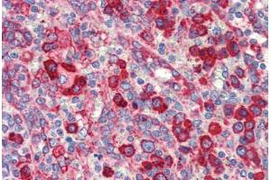 Human Spleen (formalin-fixed, paraffin-embedded) stained with HSP90B1 antibody ABIN462106 at 10 ug/ml followed by biotinylated secondary antibody, alkaline phosphatase-streptavidin and chromogen. (GRP94 anticorps)