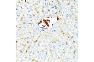 Immunohistochemistry of paraffin-embedded mouse liver using alpha 1 Spectrin antibody (ABIN6129333, ABIN6148401, ABIN6148402 and ABIN6215956) at dilution of 1:100 (40x lens). (SPTA1 anticorps  (AA 940-1160))