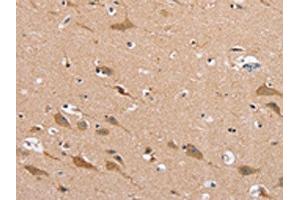 The image on the left is immunohistochemistry of paraffin-embedded Human brain tissue using ABIN7130278(MSMB Antibody) at dilution 1/30, on the right is treated with fusion protein. (MSMB anticorps)