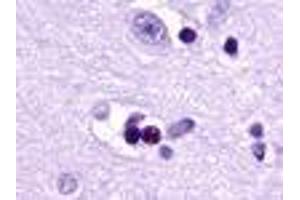 Anti-EDG2 antibody IHC of human brain, neuron and glia. (LPAR1 anticorps  (Cytoplasmic Domain))