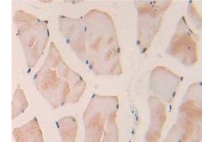 Detection of IL18 in Rat Skeletal muscle Tissue using Polyclonal Antibody to Interleukin 18 (IL18) (IL-18 anticorps  (AA 37-194))