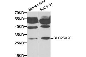 Western blot analysis of extracts of various cell lines, using SLC25A20 antibody (ABIN5974144) at 1/1000 dilution. (SLC25A20 anticorps)