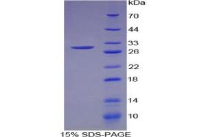 SDS-PAGE analysis of Human MEPE Protein. (MEPE Protéine)