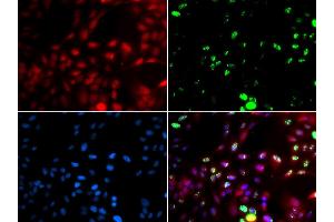 Immunofluorescence analysis of GFP-RNF168 transgenic U2OS cells using POLK antibody (ABIN5973607). (POLK anticorps)
