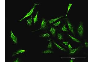 Immunofluorescence of purified MaxPab antibody to DAXX on HeLa cell.