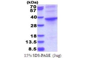 SDS-PAGE (SDS) image for Aspartate beta-Hydroxylase Domain Containing 1 (ASPHD1) (AA 96-390) protein (His tag) (ABIN5853766)