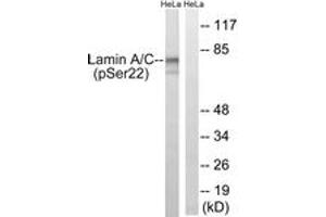 Western blot analysis of extracts from HeLa cells treated with paclitaxel 1uM 24h, using Lamin A (Phospho-Ser22) Antibody. (Lamin A/C anticorps  (pSer22))