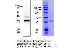 Western Blotting (WB) image for Cystic Fibrosis Transmembrane Conductance Regulator (ATP-Binding Cassette Sub-Family C, Member 7) (CFTR) (AA 1152-1480) protein (His tag) (ABIN3091166)