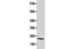 Western Blotting (WB) image for anti-Cardiac Troponin C (TNNC1) (AA 1-18), (N-Term) antibody (ABIN3043055) (TNNC1 anticorps  (N-Term))