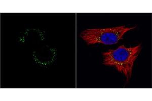 ICC/IF Image c-Met antibody [c3], c-term detects c-Met protein at cytoplasm by immunofluorescent analysis.