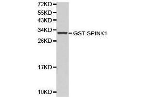Western Blotting (WB) image for anti-serine Peptidase Inhibitor, Kazal Type 1 (SPINK1) antibody (ABIN1874923) (SPINK1 anticorps)