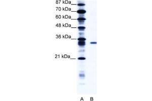 Western Blotting (WB) image for anti-Kv Channel Interacting Protein 4 (KCNIP4) antibody (ABIN2461007) (KCNIP4 anticorps)