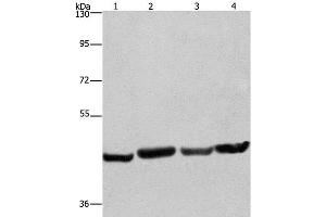 Western Blot analysis of A549, Hela, PC3 and HepG2 cell using RBMY1A1 Polyclonal Antibody at dilution of 1:360 (RBMY1A1 anticorps)