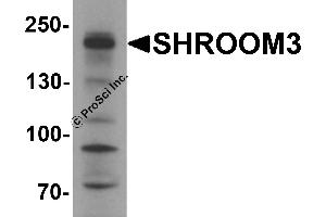 Western Blotting (WB) image for anti-Shroom Family Member 3 (SHROOM3) antibody (ABIN1077407)