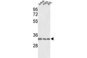 Western blot analysis of PCNA antibody and Jurkat, HeLa, 293 lysate (PCNA anticorps  (AA 231-261))