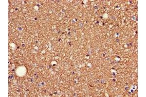 Immunohistochemistry of paraffin-embedded human brain tissue using ABIN7171195 at dilution of 1:100
