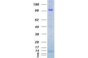 Validation with Western Blot