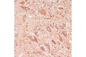 Immunohistochemistry of paraffin-embedded rat brain using G antibody (ABIN7267516) at dilution of 1:100 (40x lens).
