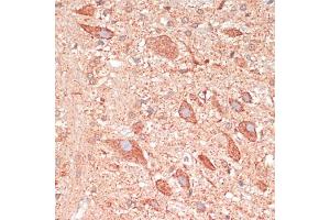 Immunohistochemistry of paraffin-embedded rat brain using G antibody (ABIN7267516) at dilution of 1:100 (40x lens). (GAP43 anticorps  (AA 1-238))