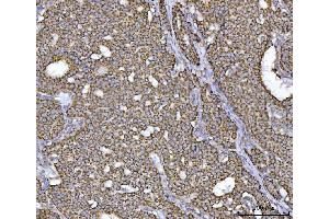 IHC analysis of ECHS1 using anti-ECHS1 antibody (ABIN7599813).