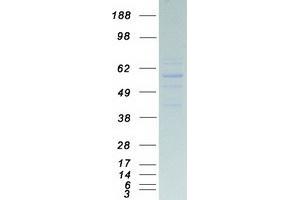 Validation with Western Blot