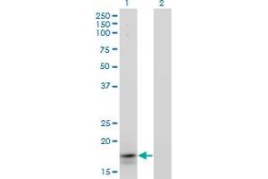 Western Blot analysis of IFNA2 expression in transfected 293T cell line by IFNA2 monoclonal antibody. (IFNA2 anticorps  (AA 24-188))