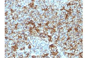 Formalin-fixed, paraffin-embedded human Pancreas stained with Spectrin beta III Monoclonal Antibody (SPTBN2/1583). (Spectrin, Beta, Non-erythrocytic 2 (SPTBN2) (AA 356-475) anticorps)
