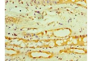 Immunohistochemistry of paraffin-embedded human kidney tissue using ABIN7154317 at dilution of 1:100 (GOPC anticorps  (AA 203-462))