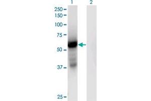 Western Blot analysis of GPT2 expression in transfected 293T cell line by GPT2 monoclonal antibody (M04), clone 7A11.
