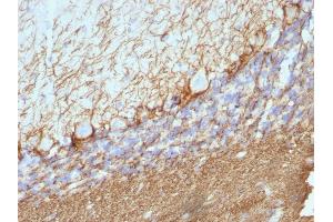 Formalin-fixed, paraffin-embedded Rat Cerebellum stained with Neurofilament Mouse Monoclonal Antibody (NE14).