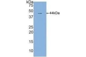 Detection of Recombinant IL6, Human using Monoclonal Antibody to Interleukin 6 (IL6) (IL-6 anticorps  (AA 30-212))
