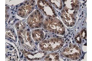 Image no. 3 for anti-Acetyl-CoA Acetyltransferase 2 (ACAT2) antibody (ABIN1496396)