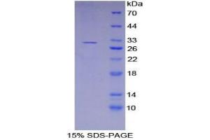 SDS-PAGE analysis of Human Kallikrein 11 Protein.