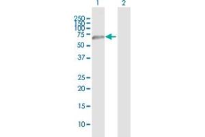 Western Blot analysis of CLEC14A expression in transfected 293T cell line by CLEC14A MaxPab polyclonal antibody.
