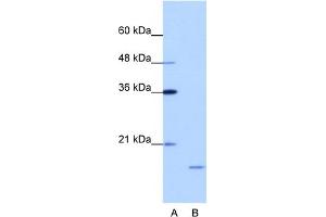 WB Suggested Anti-ISG20 Antibody Titration:  1. (ISG20 anticorps  (N-Term))