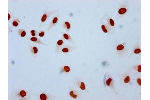 Immunocytochemistry analysis of ABIN7139609 diluted at 1:10 and staining in Hela cells performed on a Leica BondTM system.