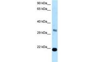 Image no. 1 for anti-FK506 Binding Protein 14, 22 KDa (FKBP14) (C-Term) antibody (ABIN6747894)