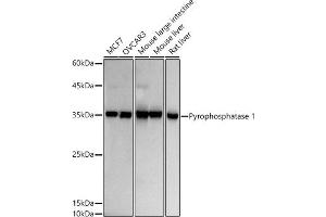 Western blot analysis of extracts of various cell lines, using Pyrophosphatase 1 antibody (ABIN7269762) at 1:500 dilution. (Pyrophosphatase (Inorganic) 1 (PPA1) anticorps)