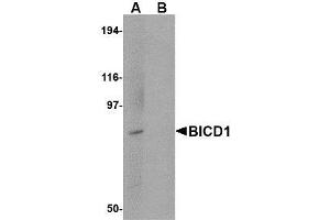 Image no. 1 for anti-Bicaudal D Homolog 1 (BICD1) (C-Term) antibody (ABIN1492179) (BICD1 anticorps  (C-Term))