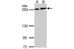 WB Image MYH9 antibody [N1], N-term detects MYH9 protein by Western blot analysis. (Myosin 9 anticorps  (N-Term))