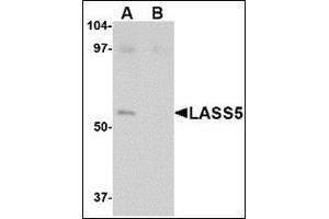 Western blot analysis of LASS5 in SK-N-SH lysate with this product at 1 μg/ml in the (A) absence and (B) presence of blocking peptide. (LASS5 anticorps  (C-Term))