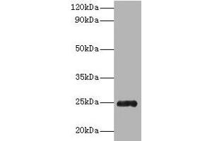 Western blot All lanes: Trypsin antibody at 2 μg/mL + Recombinant Pig Trypsin protein 1 μg Secondary Goat polyclonal to rabbit IgG at 1/10000 dilution Predicted band size: 25 kDa Observed band size: 25 kDa (Trypsin anticorps  (AA 9-231))