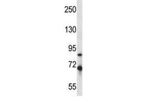 Irak1 antibody western blot analysis in mouse Neuro-2a lysate. (IRAK1 anticorps  (AA 405-433))