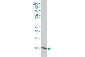 S100A2 monoclonal antibody (M03), clone 3H8 Western Blot analysis of S100A2 expression in A-431 .