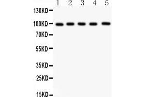 Western blot analysis of ASPH using anti-ASPH antibody (ABIN3043790). (Aspartate beta Hydroxylase anticorps  (C-Term))