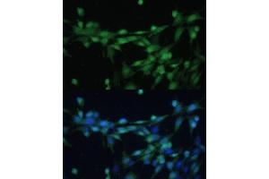 Immunofluorescence analysis of NIH-3T3 cells using Casein Kinase 2 beta (Casein Kinase 2 beta (CSNK2B)) Polyclonal Antibody (ABIN7266104) at dilution of 1:100 (40x lens).