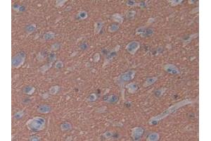 Detection of GAP43 in Human Brain Tissue using Polyclonal Antibody to Growth Associated Protein 43 (GAP43)