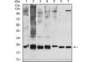 Western blot analysis using GSTP1 mouse mAb against PC-3 (1), K562 (2), Hela (3),Jurkat (4), MOLT-4 (5), HCT116 (6), and A431 (7) cell lysate.
