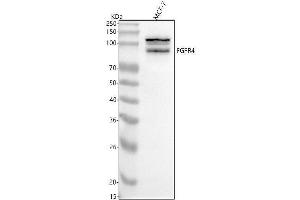 Western blot analysis of FGFR4 using anti-FGFR4 antibody (ABIN7604844).